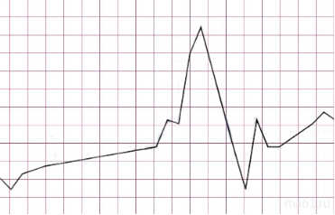 Прогноз цен на металл: апрель 2022